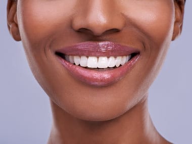 Professional tooth whitening treatment Killarney Johannesburg